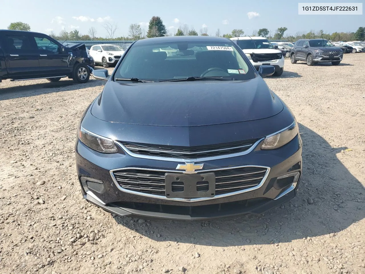 2018 Chevrolet Malibu Lt VIN: 1G1ZD5ST4JF222631 Lot: 72147504